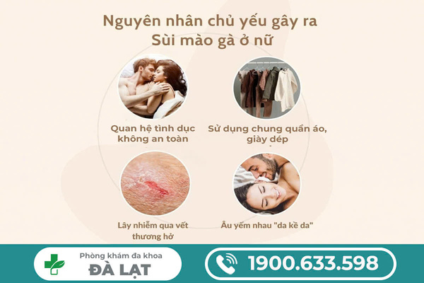 Hình ảnh minh họa